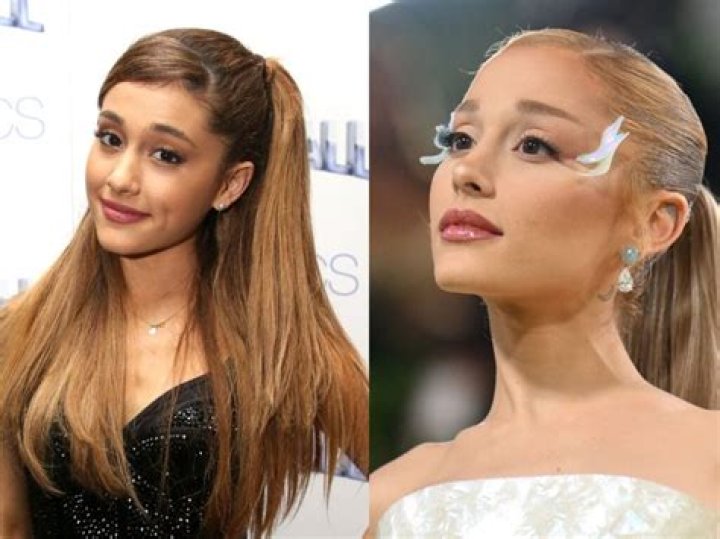 Ariana Madix's Nose Job: Unveiling The Truth