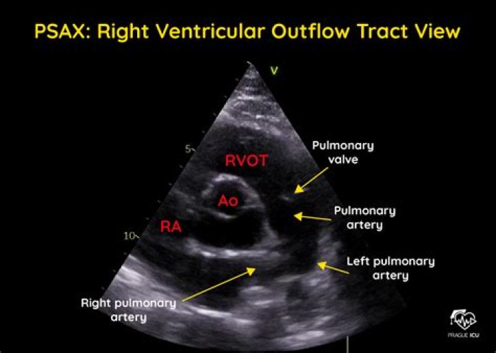 using jax lax scan with inputs that don't change across iterations within scan but are different eac